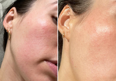 SkinGlow resultaat stralende teint