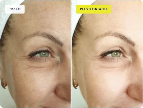 SkinGlow resultaat voor en na 28 dagen